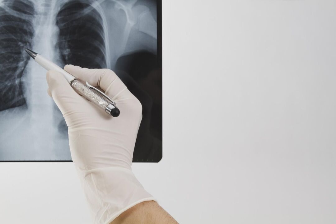 Osteoxondrozni tashxislash uchun rentgenogramma